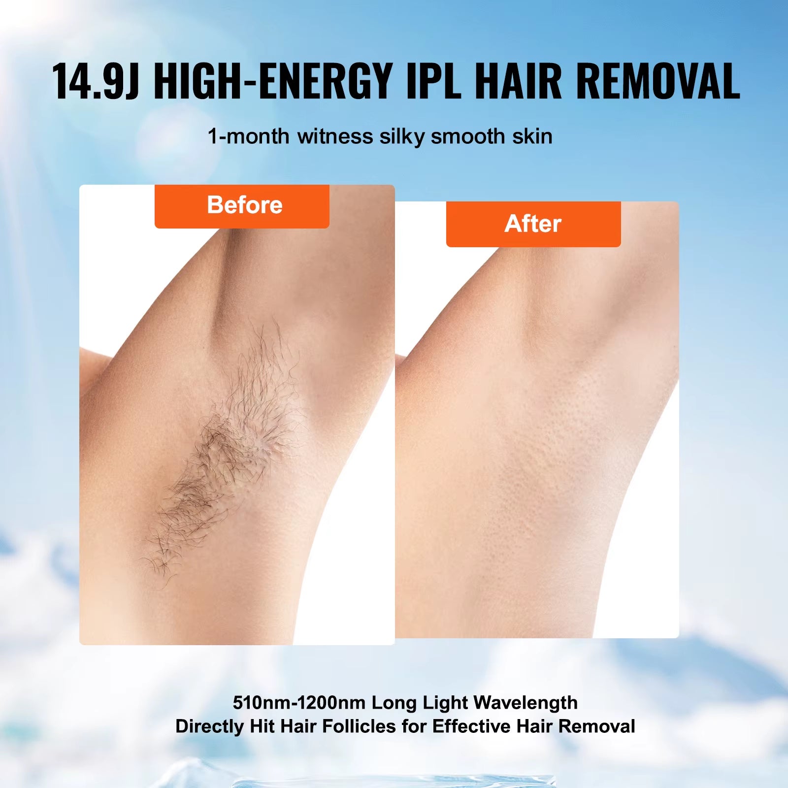 Permanent Hair Removal for Women and Men