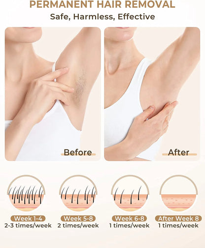 3 IN 1 IPL Laser Hair Removal for Women