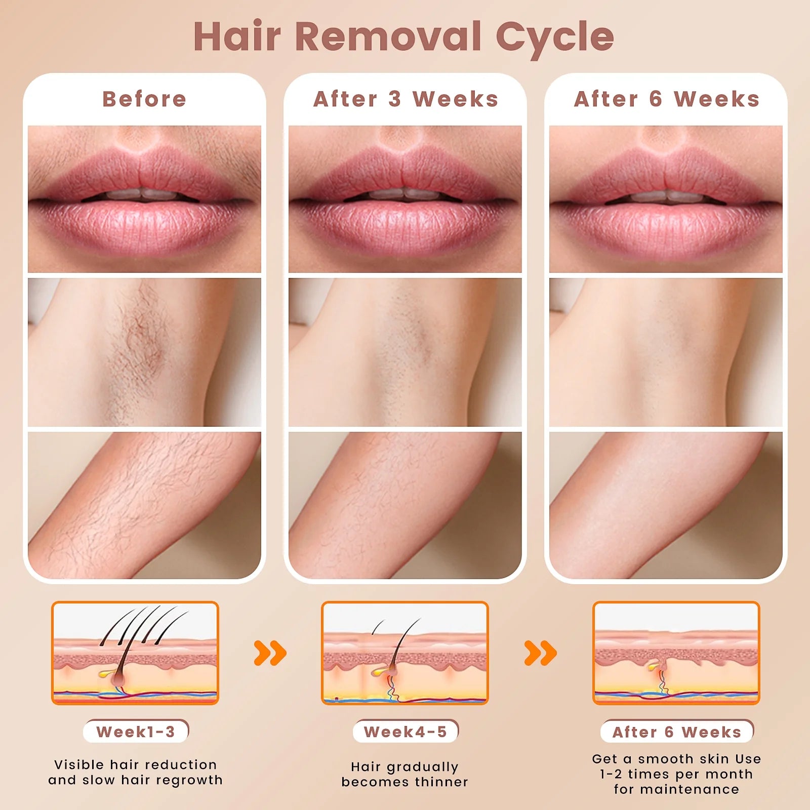 Laser IPL Hair Removal Device for Women and Men